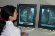 мамография, болница, изследване, лекар