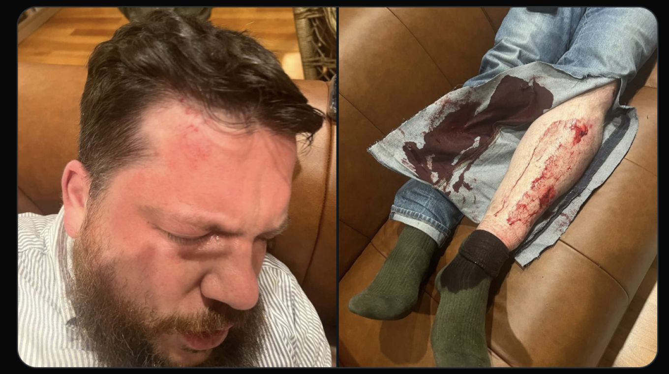 Литва обвини Русия за нападението с чук срещу съратника на Навални в изгнание Леонид Волков