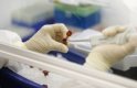 Първа жертва на свинския грип в България