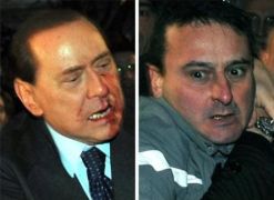 Берлускони със счупени нос и зъби след нападение