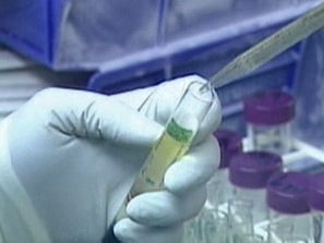 Израелски учени претендират, че са създали универсална ваксина срещу рака