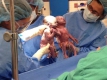 В Охайо се родиха "моно-моно" близнаци, хванати за ръка