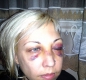 Жена се оплака от полицейски побой, МВР я обвини в хулиганство
