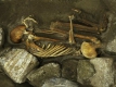 Ортопедичен пирон в египетска мумия смая лекари