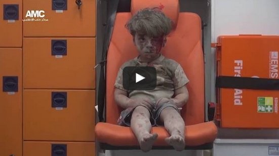 5-годишният Омран Дакнееш от Алепо, който трогна света