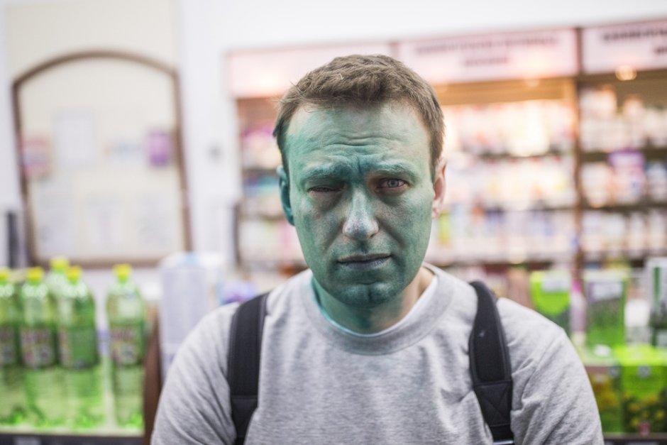 Алексей Навални след химическото нападение срещу него