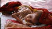 Всеки ден в Йемен по 130 деца умират поради недохранване и болести