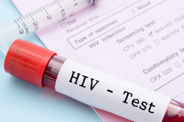 86% от българите никога не са си правили тест за ХИВ
