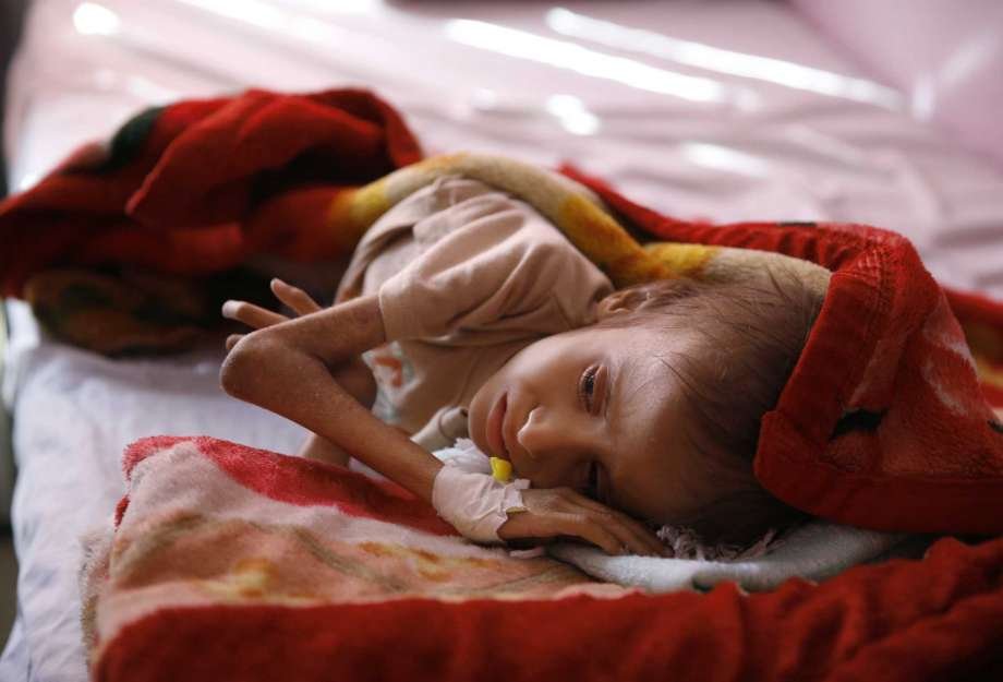 85 000 деца може би са умрели от глад в Йемен