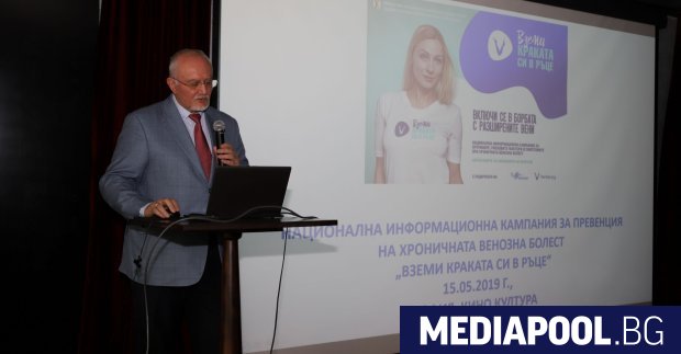 Хроничната венозна болест засяга над 50 от населението в България