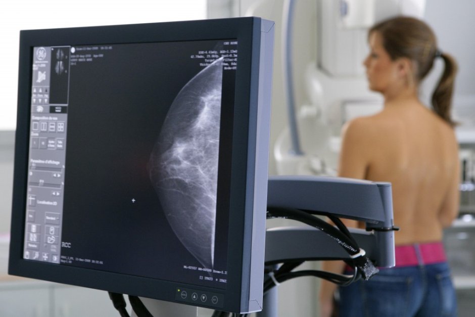 Лекари настояват НЗОК да финансира адекватно лечението на рак на гърдата