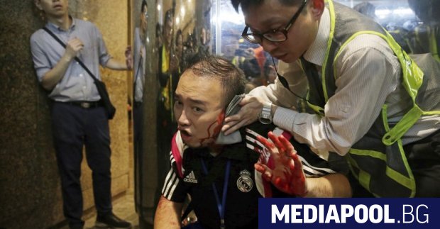 Петима души бяха ранени при атака с нож тази вечер