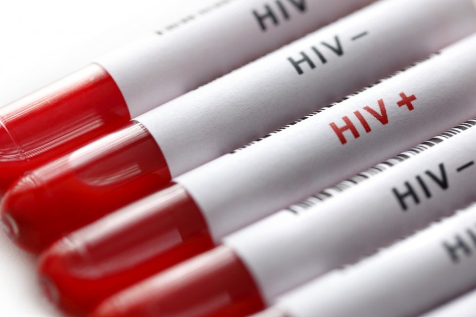 От началото на годината са открити нови 28 случая на ХИВ