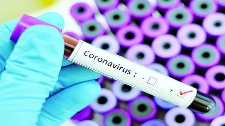 В Украйна въвеждат редица ограничения заради коронавируса