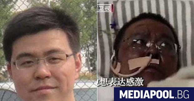 Двама китайски лекари, разболели се от Covid-19 и интубирани в