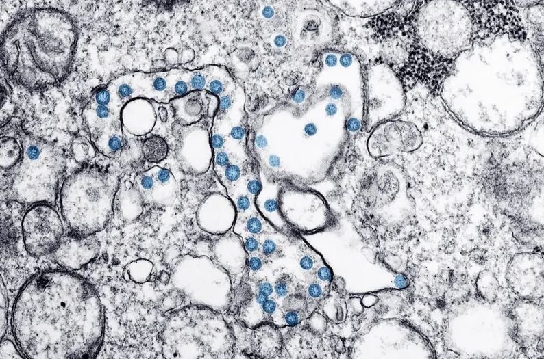 Китайски учени: Коронавирусът е мутирал и е станал най-смъртоносен в Европа