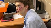 Критик на Кремъл е тежко ранен при нападение в Москва