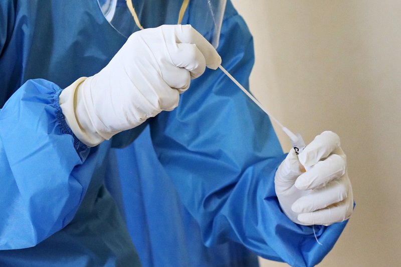 Лекар от Ямбол е повторно заразен с коронавирус