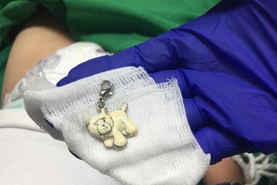 Лекари в Пазарджик спасиха двегодишно дете, глътнало ключодържател от зърнена закуска