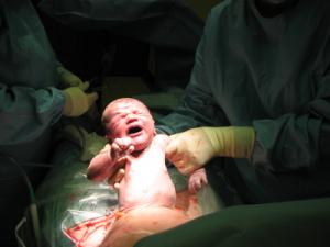 БХК сигнализира за неотчетена майчина смъртност и ненужни интервенции при раждащите жени