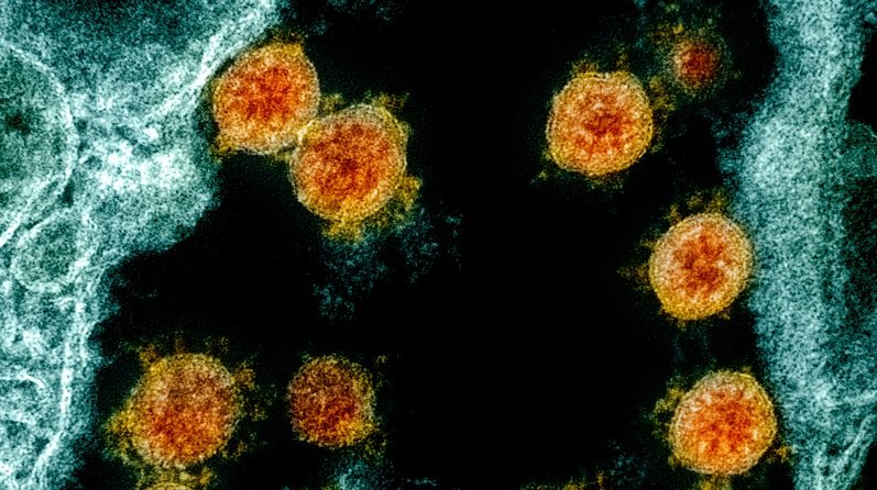 Ваксинирани майки имат антитела срещу Covid-19 в кърмата