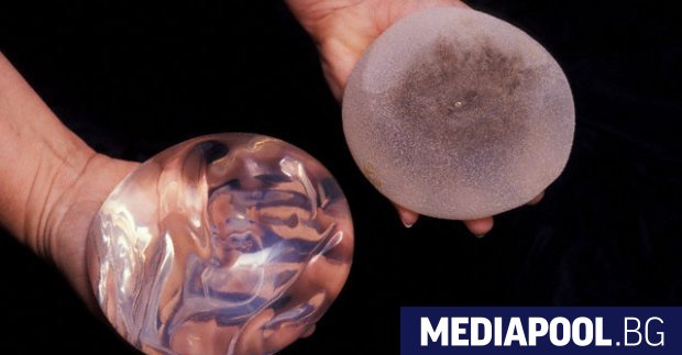 Хиляди жертви на произведени във Франция дефектни гръдни импланти трябва