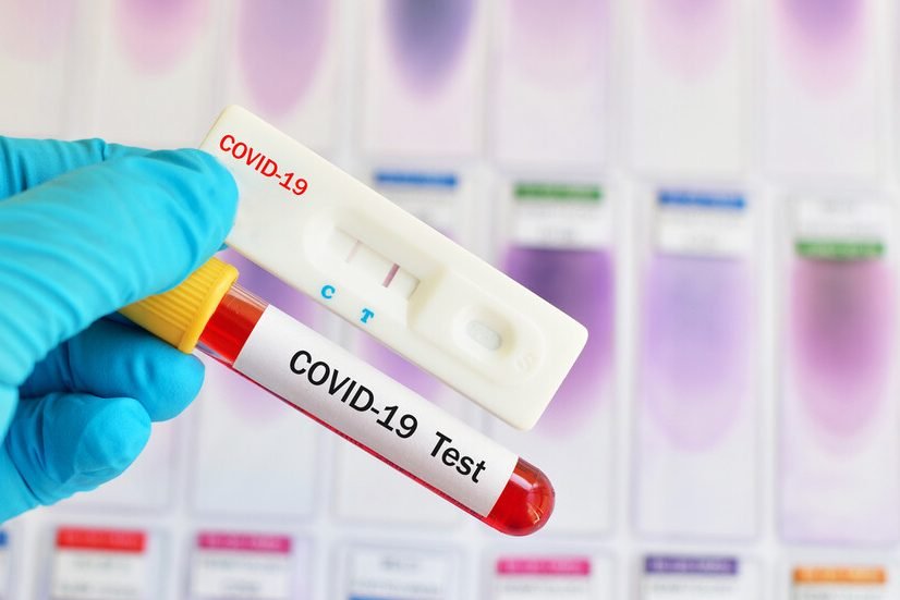 Новите случаи на коронавирус са под 3% у нас за последното денонощие