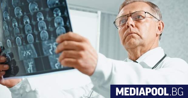 Мозъчни увреждания типични за пациенти с болестите на Алцхаймер и