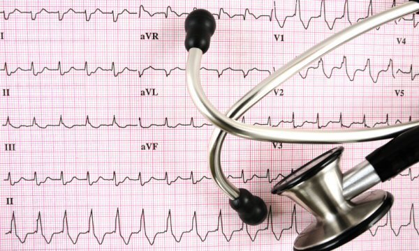 Три пъти разлика в болничната смъртност от инфаркт в различните региони на страната