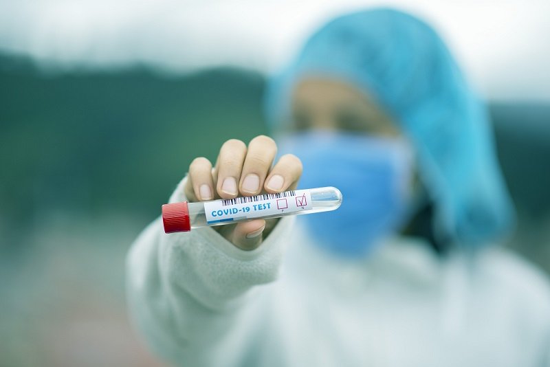 Нови 228 случая на коронавирус у нас