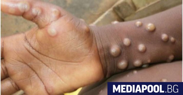 Африка все още няма нито една доза от ваксината срещу