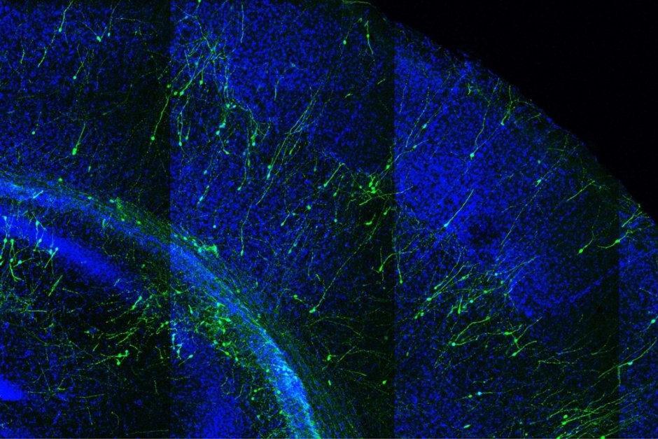 Човешки неврони, направени от стволови клетки (зелено), две седмици след трансплантация в мозък на мишка. Снимка: Пиер Вандерхаген