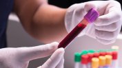 Кръвен тест, откриващ 50 вида рак, набира популярност в САЩ