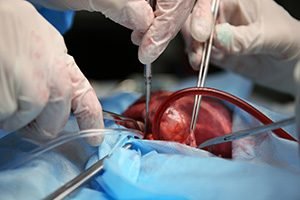 Петима румънски лекари са разследвани за повторно ползване на импланти от починали пациенти