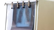 Хапче срещу рак на белия дроб намалява наполовина риска от смърт