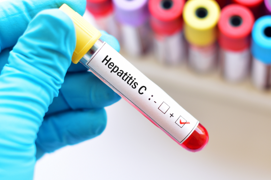 Пациентите с хепатит С вече са с облекчен достъп до терапия