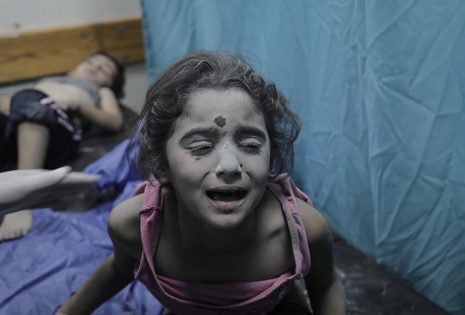 Палестински деца, ранени при израелска бомбардировка, се лекуват в болница в Хан Юнис, в южната част на Ивицата Газа. Снимка: ЕПА/БГНЕС 