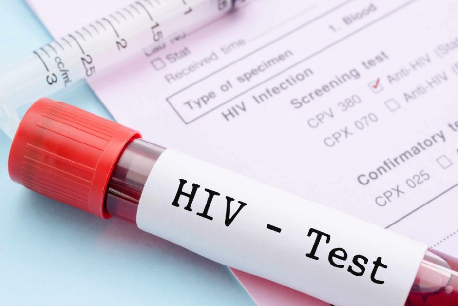 Нови 228 случая на ХИВ са регистрирани у нас от началото на годината