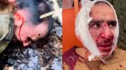 Един от задържаните за кървавата атака край Москва е с отрязано ухо и заставен да го изяде