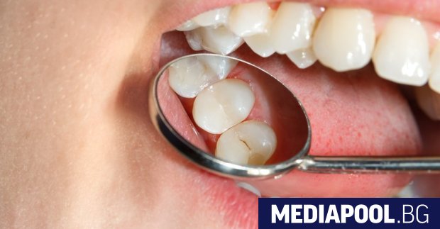 Само с промяна в диетата можем да редуцираме кариеса с
