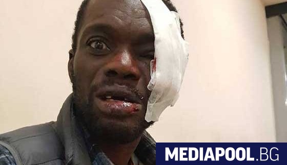 Българските власти не са разследвали ефективно расистки побой нанесен над