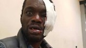 Полицията е провалила дело за расистки побой пред централата на МВР