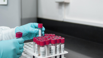 НЗОК и пациенти плащат два пъти за едни и същи изследвания: в болницата и извън нея